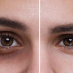 augenringe in 1 minute weg